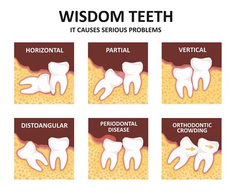  Wisdom Teeth 가 펼치는 인간 본성과 정의의 투쟁!